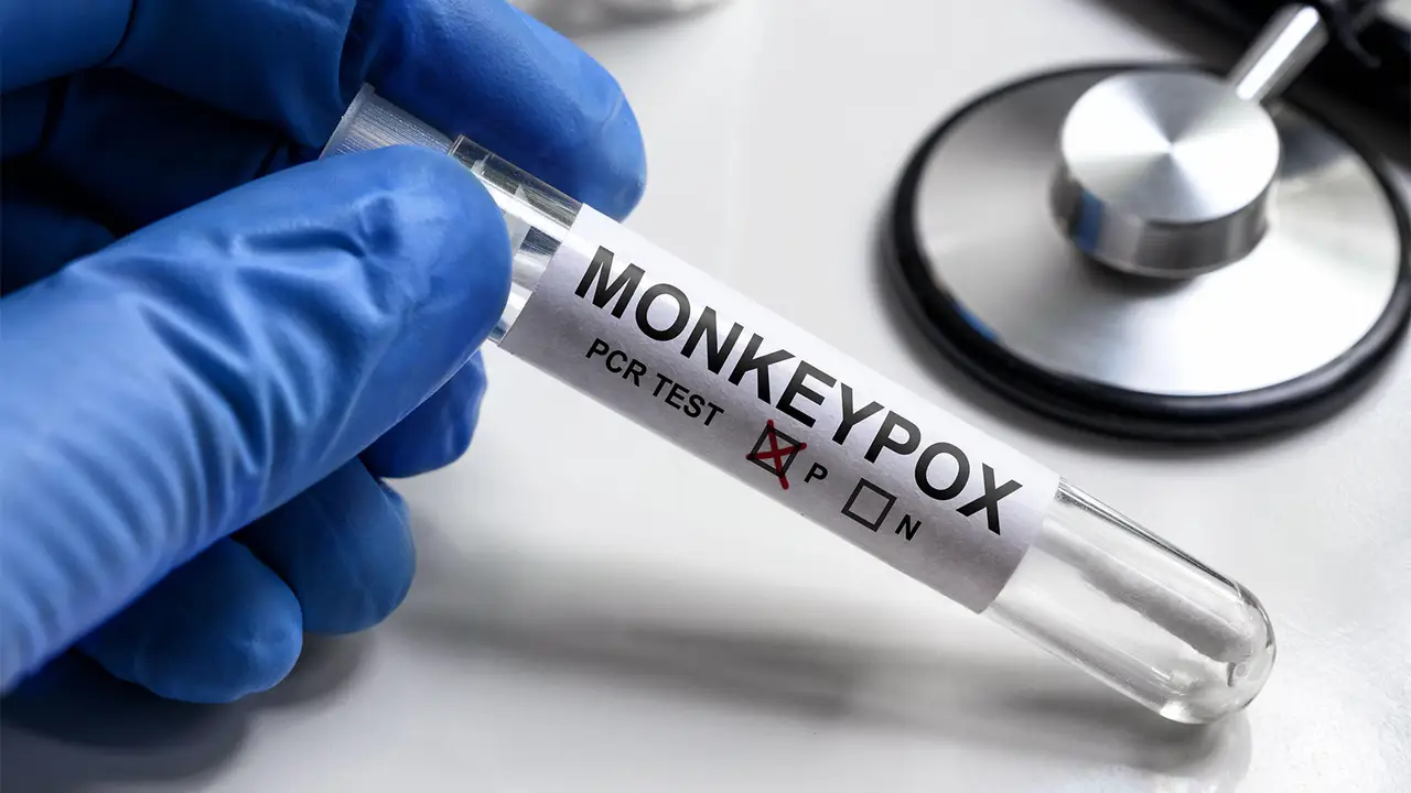 monkeypox virus